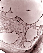 bacteria2.jpg